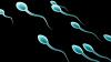Тримаючи мобільні телефони в кишенях, можна готувати сперму, знижуючи родючість, вважають експерти